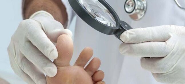 Pregledi pred začetkom zdravljenja glivic