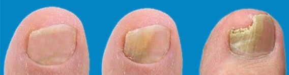 Proces razvoja glive